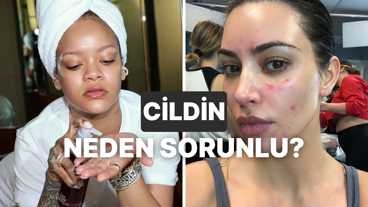 Cilt Problemlerinin Altında Yatan Gerçek Nedir?