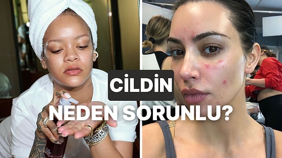 Cilt Problemlerinin Altında Yatan Gerçek Nedir?