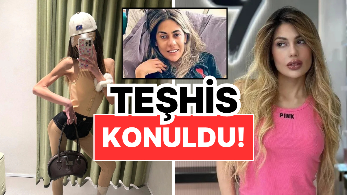 37 Kiloya Kadar Düşen Nihal Candan'ın Sağlık Durumu Kötüye Gidiyor: Organ Yetmezliği Teşhisi!