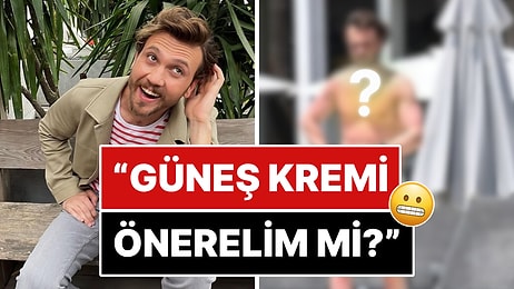 Acısı Akşama Çıkar: Yaz Sezonunu Açar Açmaz Domates Gibi Kızaran Aras Bulut İynemli Alay Konusu Oldu!