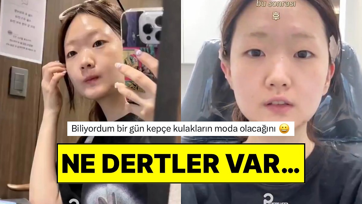 Kulak Dolgusu Operasyonu Olarak Kulaklarını Kepçe Hale Getiren Koreli Kadın