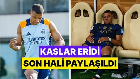 Hastaneye Kaldırılan Mbappe Bir Haftada Beş Kilo Kaybetti!
