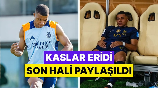 Hastaneye Kaldırılan Mbappe Bir Haftada Beş Kilo Kaybetti!