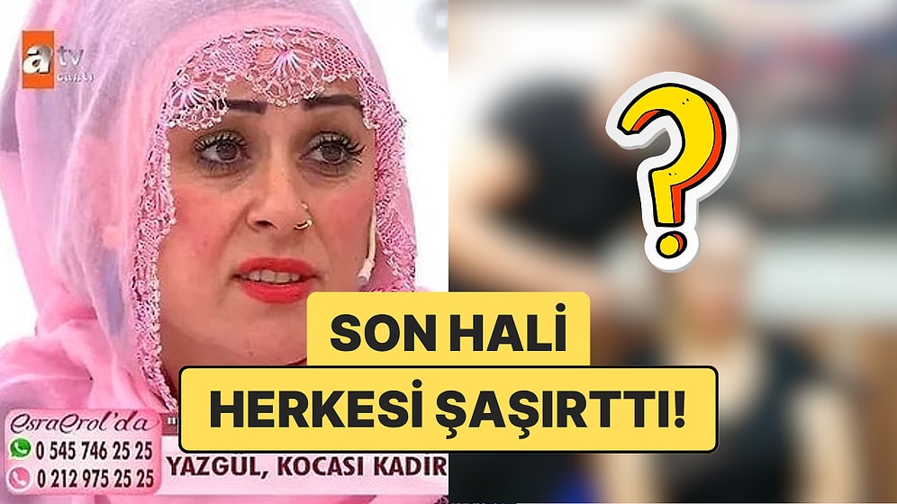 Esra Erol'da "Tek Suçum Güzel Olmak" Sözüyle Tanınan Yazgül Saç Ektirdi: Son Hali Görenleri Şaşırttı!