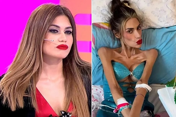 Bir süredir anoreksiya nevroza hastalığıyla mücadele eden Nihal Candan, geçtiğimiz günlerde yaşam savaşını kaybetti. Görseli