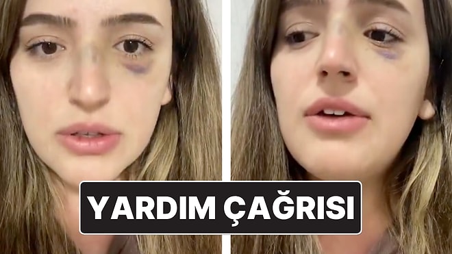 Eşinden Şiddet Gören Kadının Yardım Çağrısı: "Lütfen Sesim Olun"