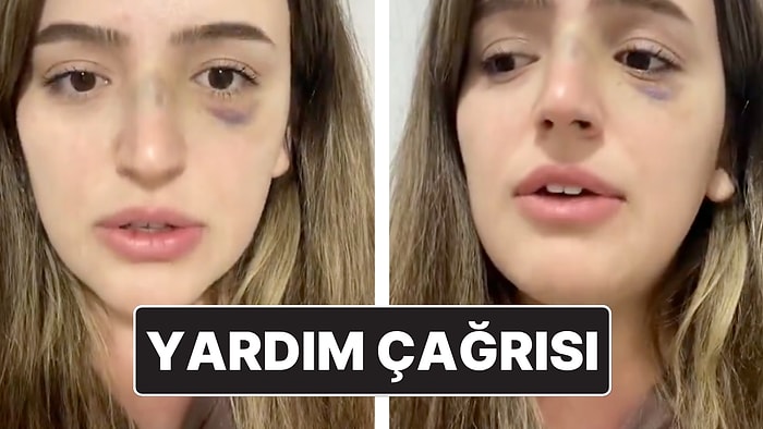 Eşinden Şiddet Gören Kadının Yardım Çağrısı: "Lütfen Sesim Olun"