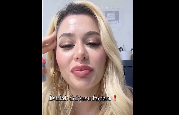 Dolgu gibi estetik operasyonlar, yüz hatlarını belirginleştirmek ve genç bir görünüm elde etmek amacıyla sıklıkla tercih edilir.