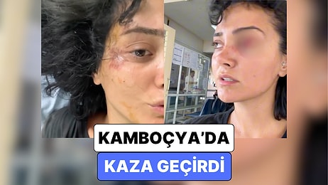 Otostop Çekerek Dünyayı Dolaşan Türk Gezgin Kamboçya'da Geçirdiği Kazanın Ardından Yaşadıklarını Paylaştı