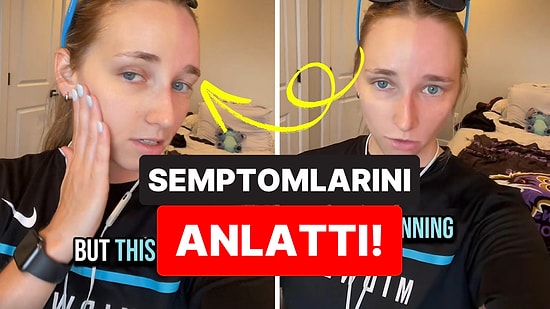 Sadece Yüzünün Yarısı Kızarıyor ve Terliyor: Harlequin Sendromunu Daha Önce Duymuş muydunuz?