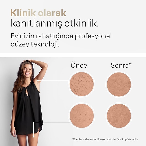 Tüm vücut uygulamaları için ideal olan 400.000 atım ömrü, uzun süreli kullanım için yeterli.