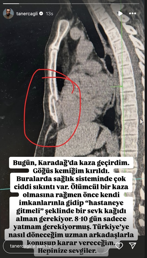 Kazanın ardından 8-10 gün yatması gerektiğini söyleyen Taner Çağlı, Türkiye’ye nasıl döneceği konusunda da kararsız olduğunu belirtti.