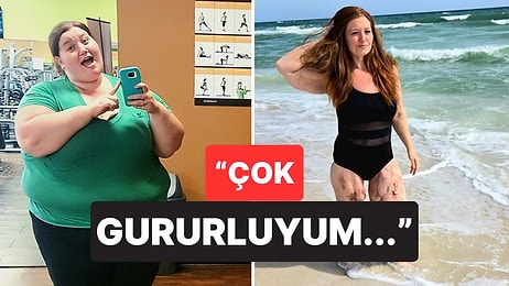 140 Kilo Vererek Hayatında Yepyeni Bir Sayfa Açan Kadının Gururlandıran Hikayesi
