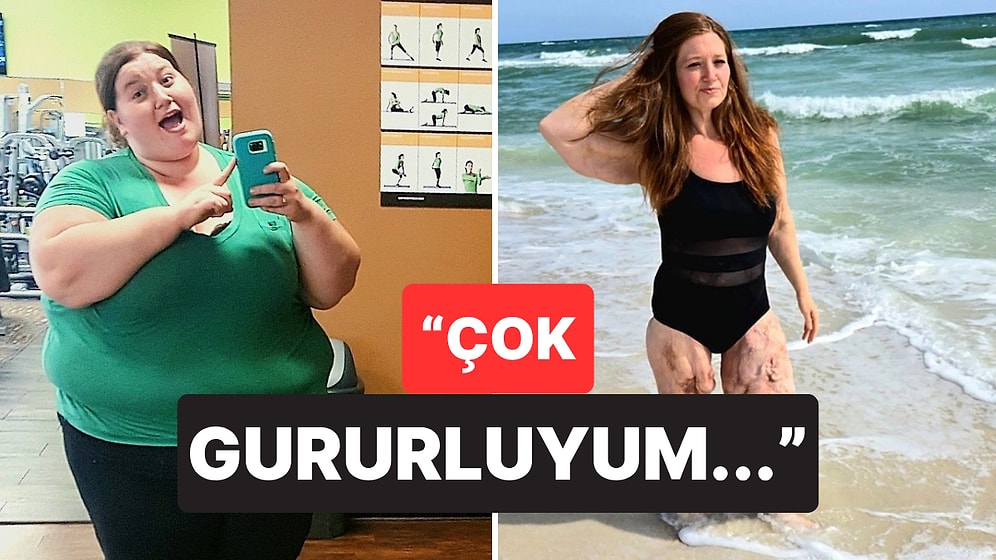 140 Kilo Vererek Hayatında Yepyeni Bir Sayfa Açan Kadının Gururlandıran Hikayesi
