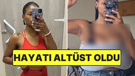Nadir Görülen Ağrılı Bir Rahatsızlık Nedeniyle Göğüsleri 5 Beden Büyüyen Genç Kadının Hikayesi