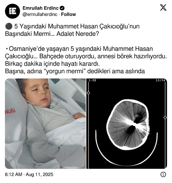 Gazeteci Emrullah Erdinç, yaşananlara isyan ederek şunları anlattı: