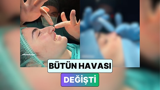 Bütün Havası Değişti: Türk Bir Doktorun Yaptığı Burun Estetiği Sosyal Medyada Viral Oldu