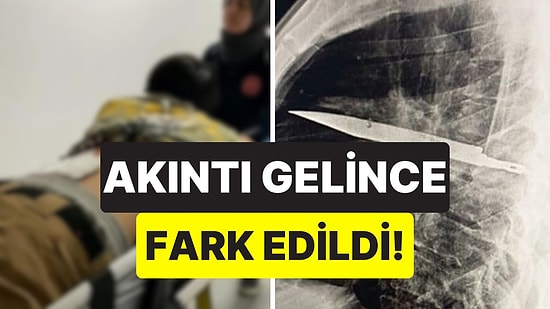 Memesinden Akıntı Gelince Fark Edildi: Göğsündeki Bıçak 8 Yıl Sonra Röntgende Ortaya Çıktı