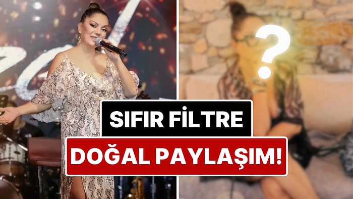 Güzellik Kalpılarına Rest Çekti: Bir Dönem Yüzündeki İzlerle Çok Konuşulan İzel'den Filtresiz Paylaşım!