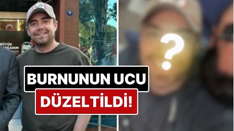 11 Kez Ameliyat Geçiren Murat Dalkılıç'ın Burnunun Ucu Estetik Müdahalelerle Düzeltildi!