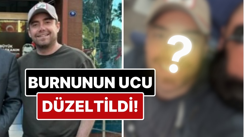 11 Kez Ameliyat Geçiren Murat Dalkılıç'ın Burnunun Ucu Estetik Müdahalelerle Düzeltildi!