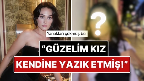 Estetik Kervanına Katıldı: Güzelliğiyle Büyüleyen Esra Bilgiç’in Estetikli Yüzü Doğal Haliyle Karşılaştırıldı!