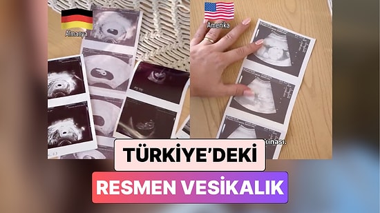 Türkiye'deki Resmen Vesikalık! Bir Kadın Farklı Ülkelerde Ultrason Çektirerek Farkını Karşılaştırdı
