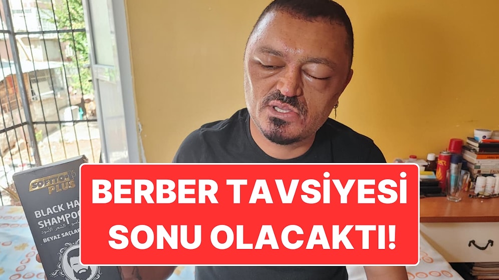 Saçını Siyahlatmak İstemişti: Adana’da Berber Tavsiyesi ile Aldığı Şampuan Yüzünden Ölümden Dönen Adam