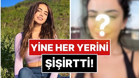 Oyunculuk Hayaliyle Estetiklerini Eriten Ece Ronay, Umduğunu Bulamayınca Yüzünü Sil Baştan Bir Daha Yaptırdı!