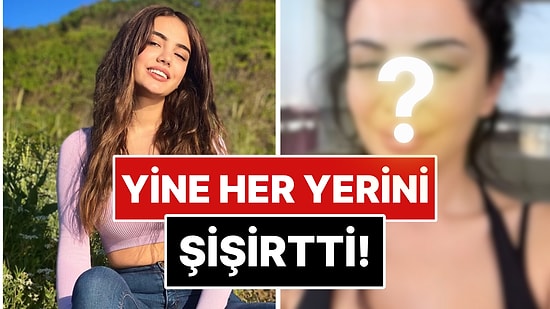Oyunculuk Hayaliyle Estetiklerini Eriten Ece Ronay, Umduğunu Bulamayınca Yüzünü Sil Baştan Bir Daha Yaptırdı!