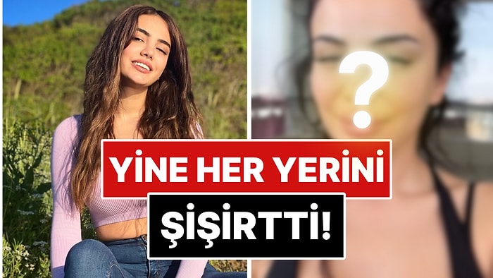 Oyunculuk Hayaliyle Estetiklerini Eriten Ece Ronay, Umduğunu Bulamayınca Yüzünü Sil Baştan Bir Daha Yaptırdı!