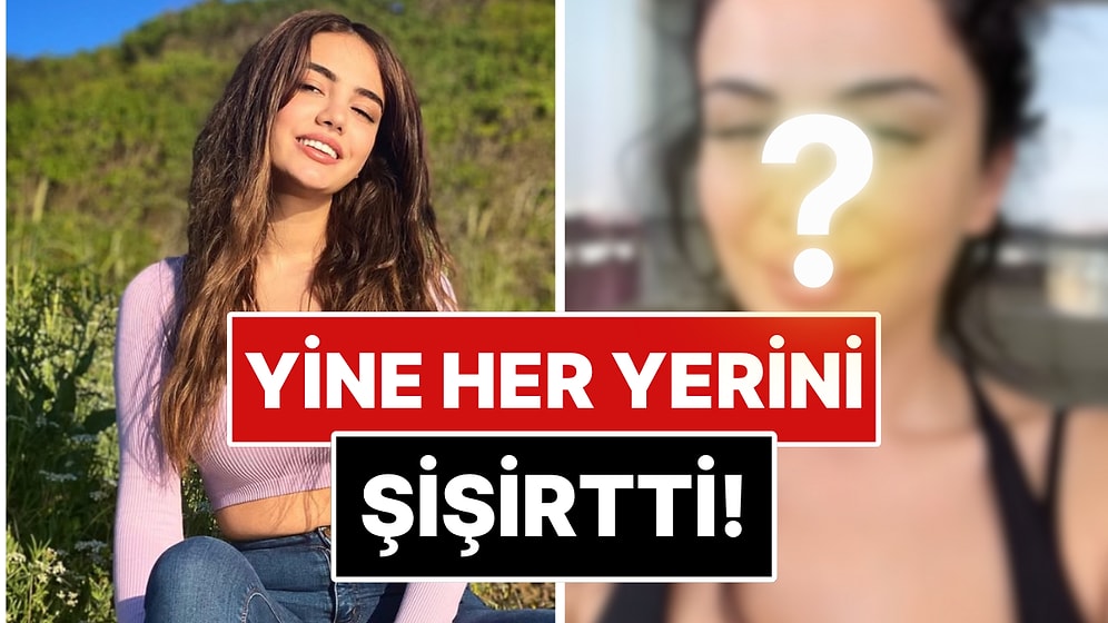 Oyunculuk Hayaliyle Estetiklerini Eriten Ece Ronay, Umduğunu Bulamayınca Yüzünü Sil Baştan Bir Daha Yaptırdı!