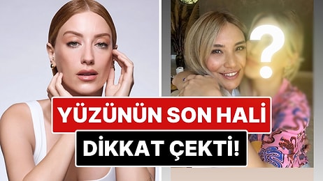 Estetik mi Yaptırdı? Bir Güzellik Merkezinden Paylaşım Yapan Hazal Kaya'nın Yüzündeki Değişim Dikkat Çekti!
