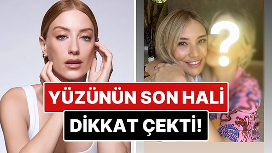 Estetik mi Yaptırdı? Bir Güzellik Merkezinden Paylaşım Yapan Hazal Kaya'nın Yüzündeki Değişim Dikkat Çekti!