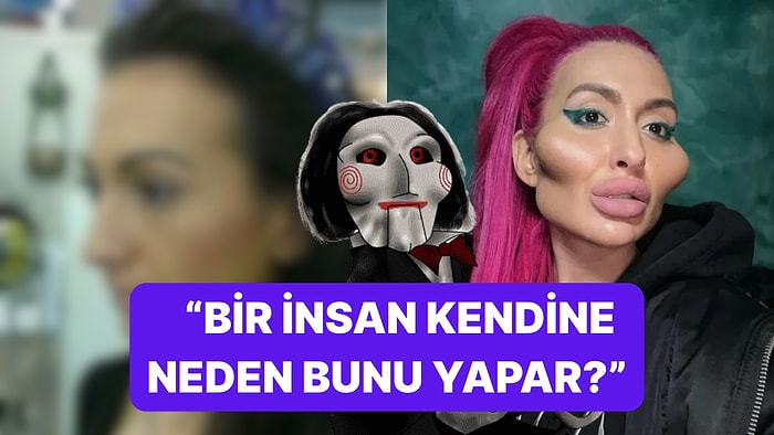 Onlar da Akıllıya Hasret: Dünyanın En Büyük Elmacık Kemiklerine Sahip Modelin Eski Hali