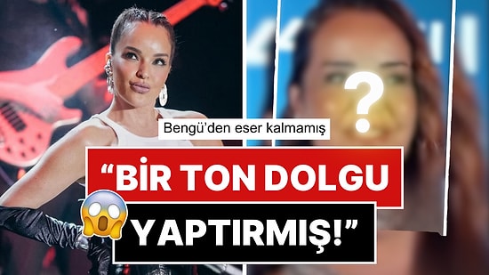 Hiç Estetik Yaptırmadığını İddia Eden Şarkıcı Bengü'nün Yüzündeki Büyük Değişim Hayrete Düşürdü!