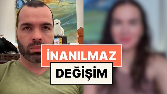 Türkiye’de 4 Yıl Önce Saç Ektiren TikTok Fenomeninin Şok Etkisi Yaratan Değişimi