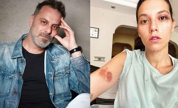 Bulutsuz ise sosyal medya hesabından “Cezaevine gireceği günü bekliyorum” sözleriyle gündem yaratmıştı.