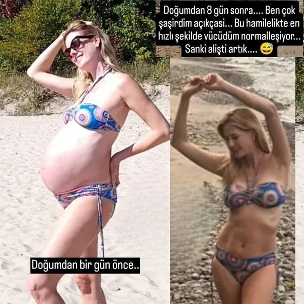 Wilma Elles, geçtiğimiz günlerde doğumdan bir gün önceki ve sekiz gün sonraki halini Instagram hikayesinden paylaştı.