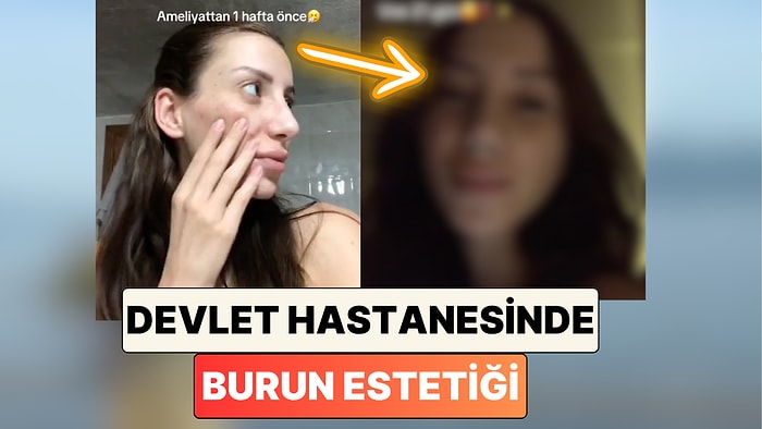 Devlet Hastanesinde Burun Estetiği Yaptıran Bir Kadın Yaşadığı Süreci Paylaştı