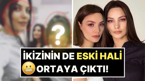 Hiç Estetiği Olmadığını Savunan Hazal Filiz Küçükköse, Bu Sefer Tek Yumurta İkizini Öne Sürmeyi Denedi!
