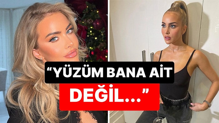 34 Yaşındaki İnternet Fenomeninin Dolgu Kabusu: Saatlerce Masada Kaldı