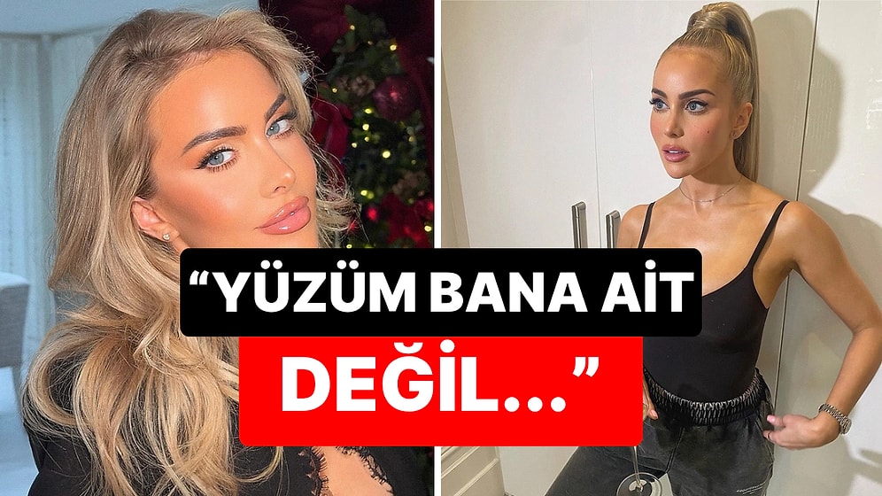 34 Yaşındaki İnternet Fenomeninin Dolgu Kabusu: Saatlerce Masada Kaldı