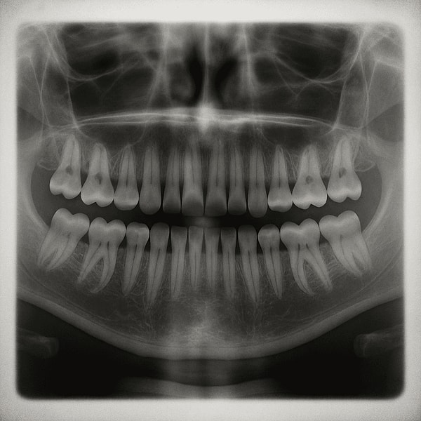 Dr. Katsu Takahashi and his team from the Medical Research Institute Kitano Hospital in Osaka have been studying the genetic foundations of tooth development for years.