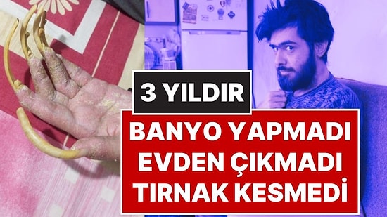 3 Yıldır Evden Çıkmadı, Banyo Yapmadı, Tırnak Kesmedi: 23 Yaşındaki Barış Oyun Bağımlısı Oldu