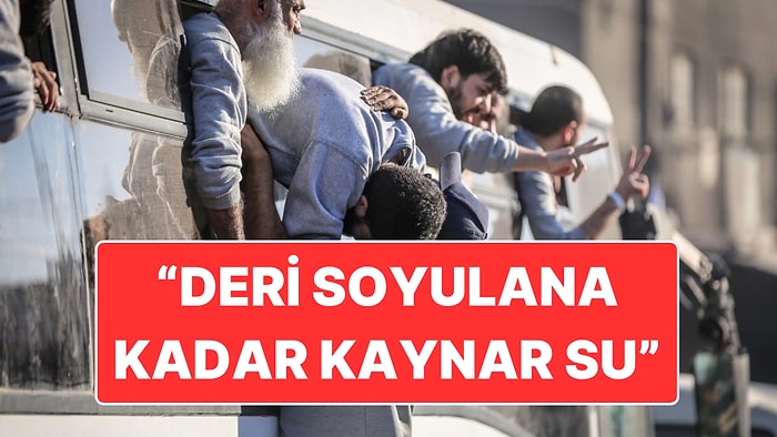 Soykırımcı İsrail'in Hapishanelerde Yaptığı İşkence: "Deri Soyulana Kadar Kaynar Su Döktüler"