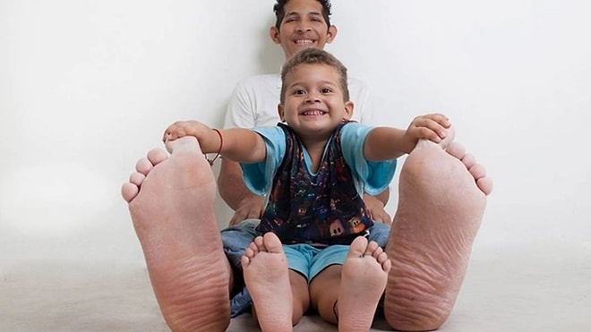 The Heartbreaking Story of Jeison Rodríguez, the Man with the World’s Largest Feet