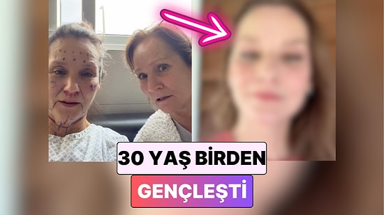 30 Yaş Gençleşti: Aynı Anda Birkaç Estetik Operasyon Geçiren Kadın İnanılmaz Değişimiyle Şaşırttı