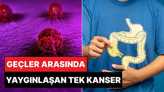 Uzmanlar Uyardı: Gençler Arasında Bu Kanser Türü Yaygınlaşmaya Başladı