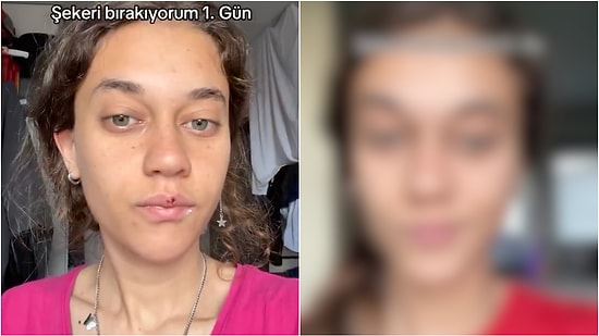 Woman Who Completely Eliminated Sugar from Her Life Shares Her Transformation in 5 Months